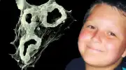 Naegleria fowleri Enfeksiyonu Hakkında Bilimsel Detaylar ve Risk Faktörleri