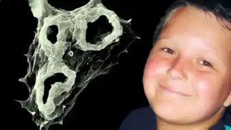 Naegleria fowleri Enfeksiyonu Hakkında Bilimsel Detaylar ve Risk Faktörleri