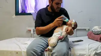 İsrail Saldırısında Annesini Kaybeden 50 Günlük Bebek Muhammed'in Bacağı Ampute Edildi
