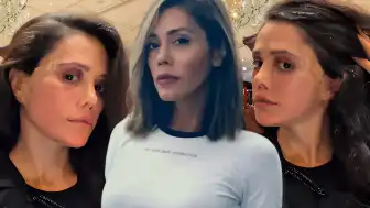 Sosyal Medya Fenomeni Didem Ceran'dan Estetik Operasyon Sonrası Yüz Felci Açıklaması